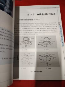 脊柱内固定系统应用指南