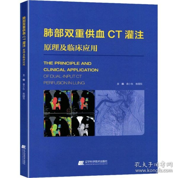 肺部双重供血CT灌注原理及临床应用