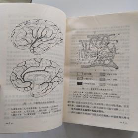 脑血管疾病 第二版(85品小32开1984年2版4印26520册626页41万字)54487
