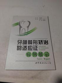 牙颌畸形矫治的适应证：病例展示