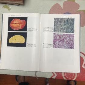 Atlas der pathologischen Anatomie病理解剖图谱(品自鉴）