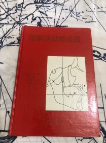 图解活动矫治器