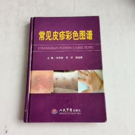 常見皮疹彩色圖譜