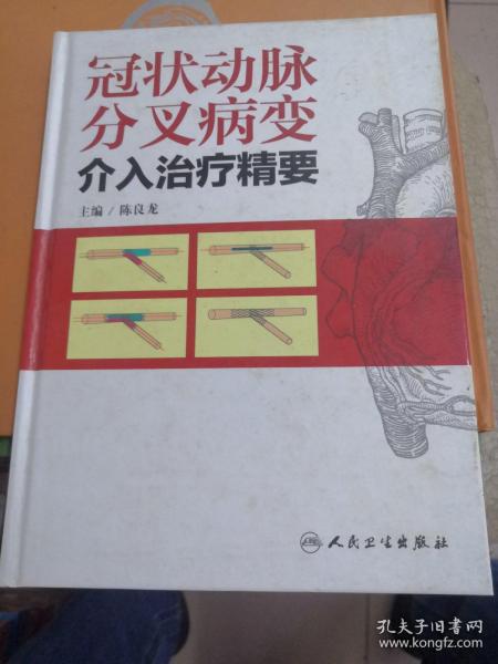 冠状动脉分叉病变介入治疗精要