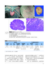 胃与肠：希望大家了解的十二指肠病变