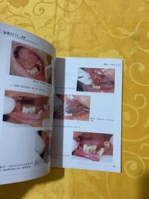 口腔临床操作技术丛书·标准拔牙手术图谱