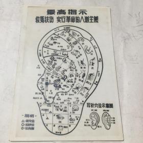 耳针穴位示意图