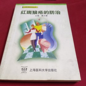 红斑狼疮的防治