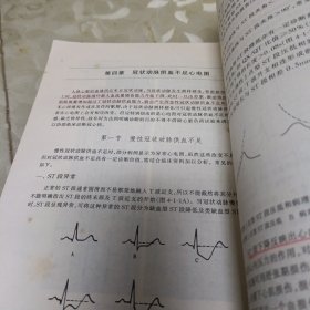 新编心电图诊断学