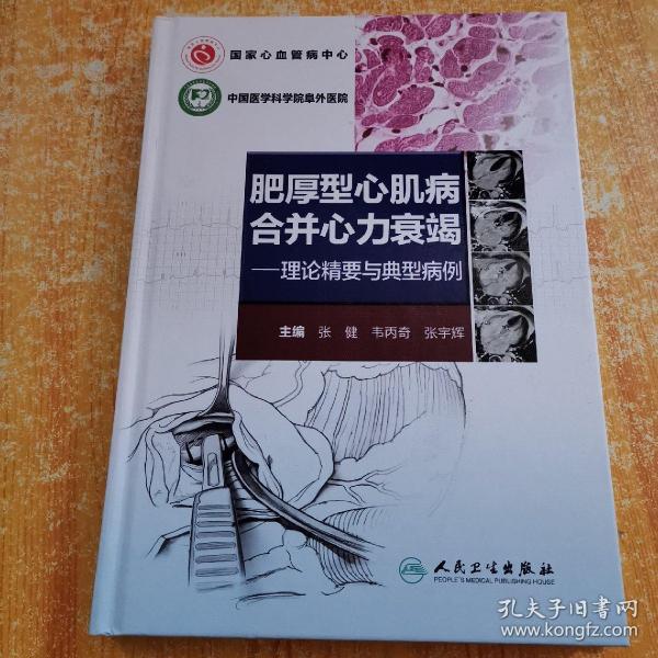 肥厚型心肌病合并心力衰竭·理论精要与典型病例