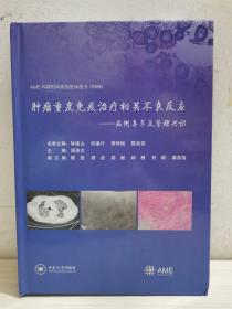 肿瘤重度免疫治疗相关不良反应——病例集萃及管理共识