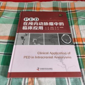 PED在颅内动脉瘤中的临床应用