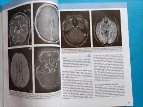 MR Neuroimaging
   Brain,Spine,Peripheral Nerves
  （脑、脊柱、外周神经的MR神经成像）