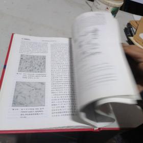 骨肌疾病体外冲击波疗法   作者签赠本