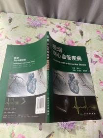 吸烟与心血管疾病