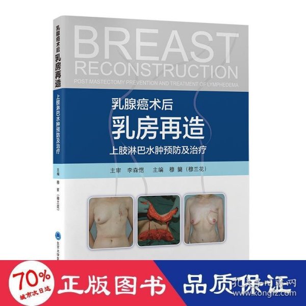 乳腺癌术后乳房再造上肢淋巴水肿预防及治疗