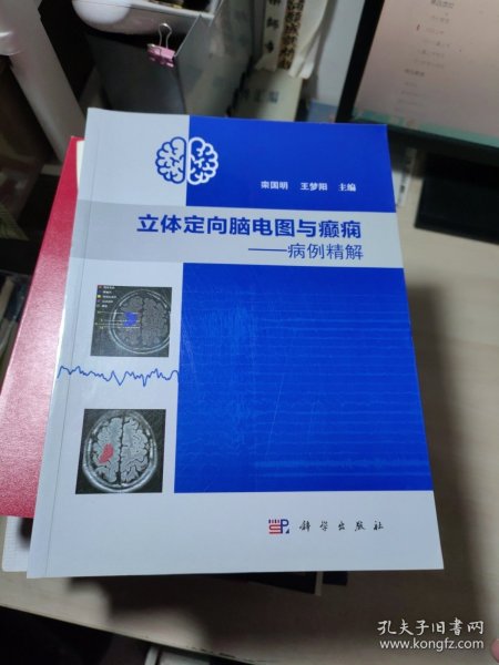 立体定向脑电图与癫痫——病例精解