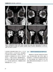 内镜眼眶外科学 解剖学基础、病理学和治疗