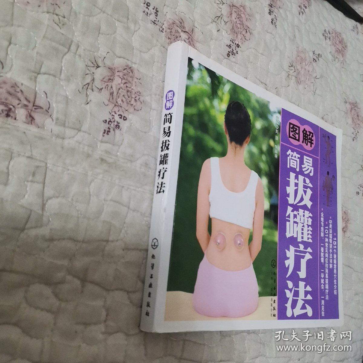 图解简易拔罐疗法