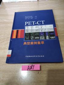 PET-CT典型案例集萃