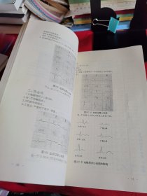 《临床心电图诊断手册》【正版现货，品如图所有图片都是实物拍摄】