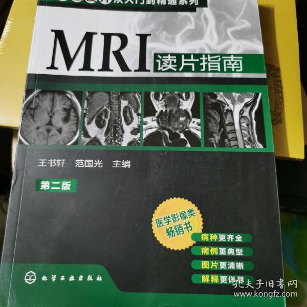 影像读片从入门到精通系列：MRI读片指南（第2版）