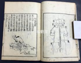 《按腹图解》1册全，和刻本，文政10年，1827年版，中医汉医导引疗法，腹部按压按摩疗法稀见著作，内分家法导引三术图解，伏人疗术图解，家法按腹十三术图解，小儿按腹图解，孕妇按腹图解，自行按腹图解，收神术，归元术等部分，并含大量精美木版插图等，画工为村田嘉言。