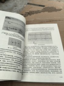 手外科学