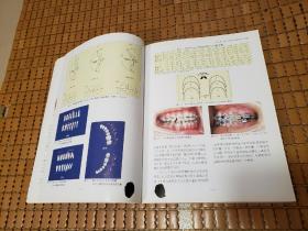 平直弓丝矫治技术——一种新型直丝弓矫治技术的理论与临床