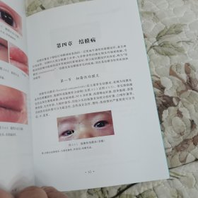 儿童常见眼病诊断图谱