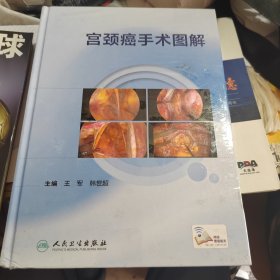 宫颈癌手术图解