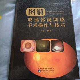 图解 玻璃体视网膜手术操作与技巧