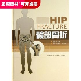 髋部骨折