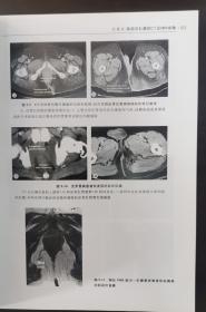 盆底与肛管直肠疾病影像学图谱 （正版书，请买者仔细看图片）