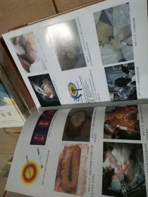 肝胆胰脾疾病的微创介入治疗