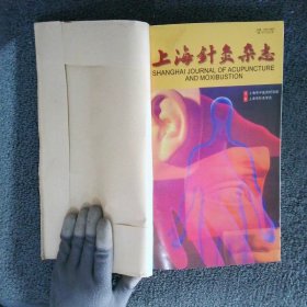 上海针灸杂志2004 1-12