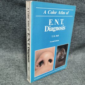 the color atlas of ent diagnosis