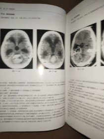 CT读片指南