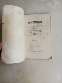 整骨手法图解