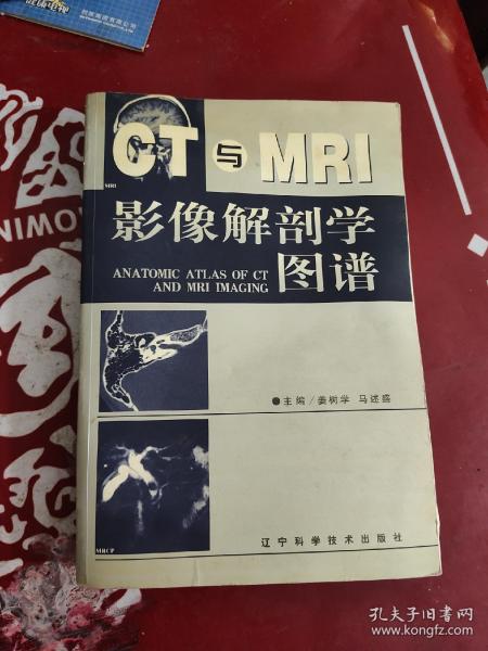 CT与MRI影像解剖学图谱