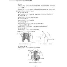 脊柱侧弯针刀整体松解治疗与康复/专科专病针刀整体松解治疗与康复丛书