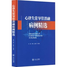 心律失常导管消融病例精选