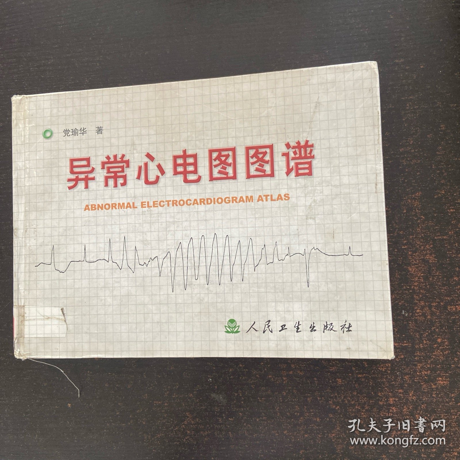 异常心电图图谱