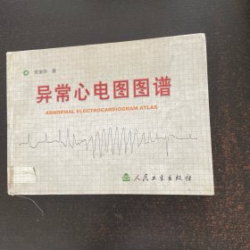 异常心电图图谱