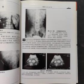 泌尿男生殖疾病影像学图鉴——临床影像学图鉴系列