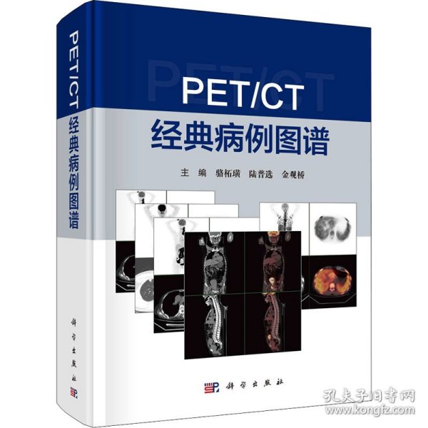 PET/CT 经典病例图谱