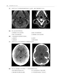 神经影像学：核心复习