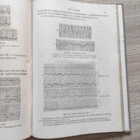 心电图、心向量图学