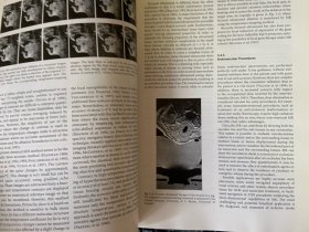 【英文原版】Interventional Magnetic Resonance Imaging 介入性磁共振成像