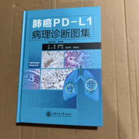 肺癌PD-L1病理诊断图集